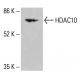 Histone Deacetylase 10 (HDAC10) Antibody (E-2) - Western Blotting - Image 415256