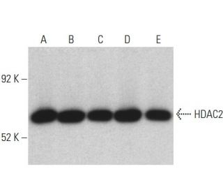 Histone Deacetylase 2 (HDAC2) Antibody (3F3) - Western Blotting - Image 398070 