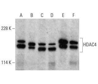 western blotting image from recommended Histone Deacetylase 4 (HDAC4) (A-4) monoclonal antibody replacement. Image 381025