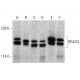 このポリクローナル抗体は販売終了となりました。弊社推奨の<a href="hdac4-antibody-a-4">Histone Deacetylase 4 (HDAC4) (A-4)</a>モノクローナル抗体をご覧ください(サンプルデータを表示)。 western blotting image from recommended Histone Deacetylase 4 (HDAC4) (A-4) monoclonal antibody replacement. Image 381025
