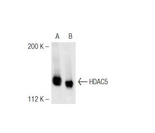Histone Deacetylase 5 (HDAC5) Antibody (B-11) - Western Blotting - Image 43019 