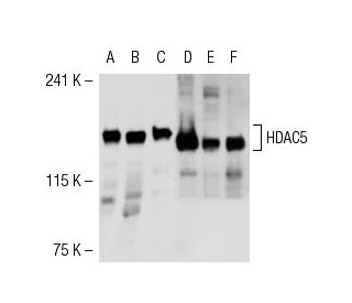 western blotting image from recommended Histone Deacetylase 5 (HDAC5) (C-11) monoclonal antibody replacement. Image 54266