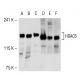 western blotting image from recommended Histone Deacetylase 5 (HDAC5) (C-11) monoclonal antibody replacement. Image 54266