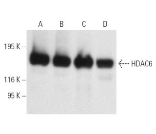 western blotting image from recommended Histone Deacetylase 6 (HDAC6) (D-11) monoclonal antibody replacement. Image 9884