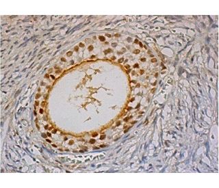 Histone Deacetylase 8 (HDAC8) Antibody (B-4) - Immunohistochemistry - Image 286403 