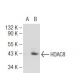 Histone Deacetylase 8 (HDAC8) Antibody (HDAC8-48) - Western Blotting - Image 127008