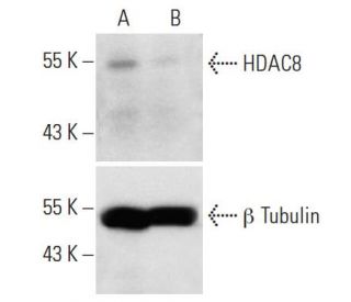 HDAC8 siRNA (h): sc-35548. Western blot analysis of HDAC8 expression in non-transfected control (A) and HDAC8 siRNA transf 