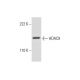 Histone Deacetylase 9 (HDAC9) Antibody (B-1) - Western Blotting - Image 300427 