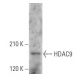 Histone Deacetylase 9 (HDAC9) Antibody (B-1) - Western Blotting - Image 354406