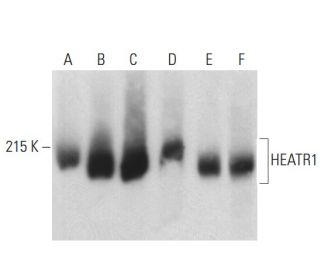 HEATR1 Antibody (B-11) - Western Blotting - Image 398104 