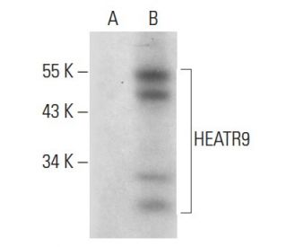 HEATR9 Antibody (C-1) - Western Blotting - Image 311744