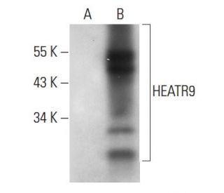HEATR9 Antibody (G-6) - Western Blotting - Image 311743