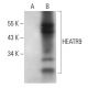 HEATR9 Antibody (G-6) - Western Blotting - Image 311743