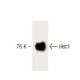 Hec1 Antibody (1) - Western Blotting - Image 60187 