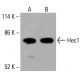 Hec1 Antibody (C-11) - Western Blotting - Image 416038
