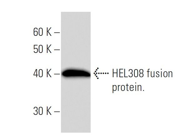 HEL308 Antibody (2406C1a) | SCBT - Santa Cruz Biotechnology