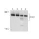HELIC2 Antibody (B-11) - Western Blotting - Image 296231 