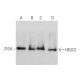 HELIC2 Antibody (G-9) - Western Blotting - Image 376713