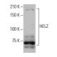 HELZ Antibody (FA-52) - Western Blotting - Image 54003