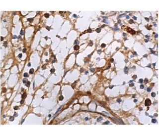 Heme Oxygenase 1/HMOX1 Antibody (A-3) | SCBT - Santa Cruz