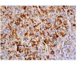 Heme Oxygenase 1/HMOX1 Antibody (A-3) | SCBT - Santa Cruz