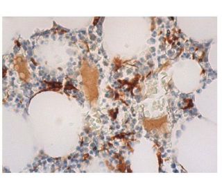 Heme Oxygenase 1/HMOX1 Antibody (A-3) | SCBT - Santa Cruz