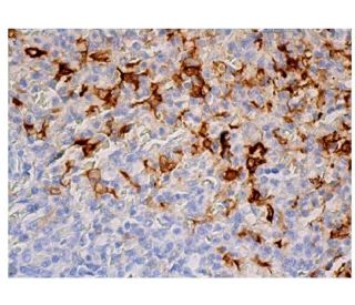 Heme Oxygenase 1/HMOX1 Antibody (D-8) | SCBT - Santa Cruz