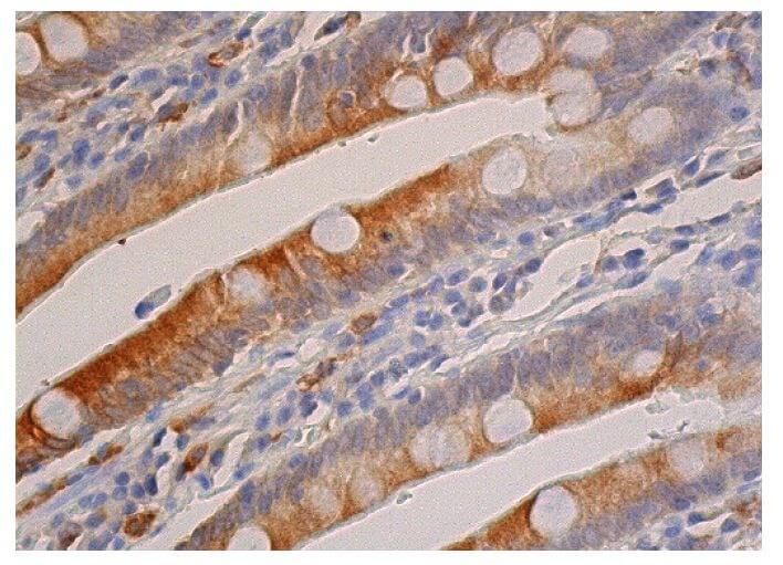 Heme Oxygenase 1/HMOX1 Antibody (D-8) | SCBT - Santa Cruz