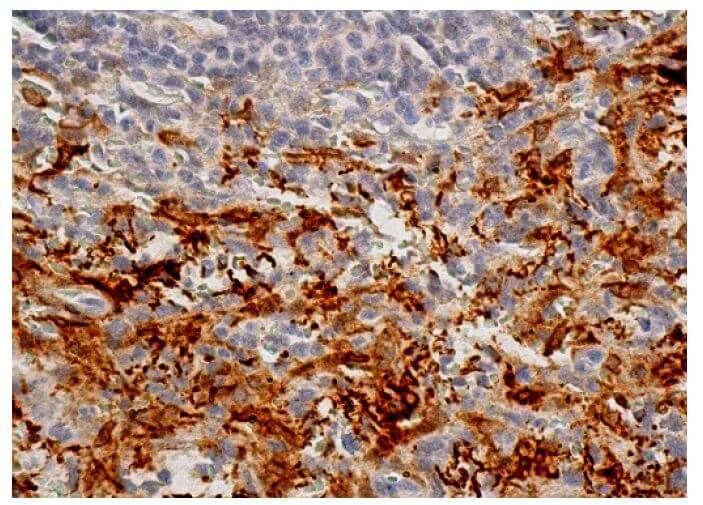 Heme Oxygenase 1/HMOX1 Antibody (F-4) | SCBT - Santa Cruz