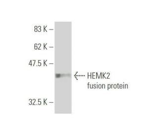 HEMK2 Antibody (1C4) - Western Blotting - Image 349567