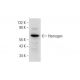 Hemogen Antibody (C-5) - Western Blotting - Image 331195