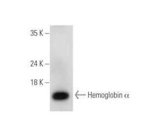 Hemoglobin &alpha; Antibody (B-9) - Western Blotting - Image 333487 