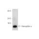 Hemoglobin α Antibody (B-9) - Western Blotting - Image 333487 