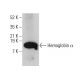 Hemoglobin α Antibody (B-9) - Western Blotting - Image 378749
