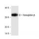 Hemoglobin β Antibody (18) - Western Blotting - Image 136759