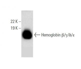 western blotting image from recommended Hemoglobin &beta;/&gamma;/&delta;/&epsilon; (A-8) monoclonal antibody replacement. Image 289019