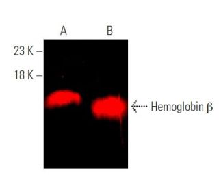 Hemoglobin β Antibody (37-8) - Western Blotting - Image 375303
