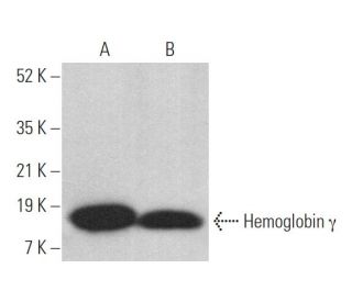 Hemoglobin &gamma; Antibody (51-7) - Western Blotting - Image 375171 