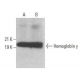 Hemoglobin γ Antibody (B-4) - Western Blotting - Image 354036 