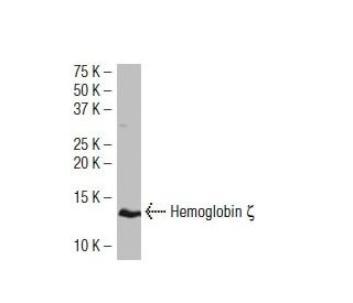 Hemoglobin &zeta; Antibody (C-1B3) - Western Blotting - Image 34632
