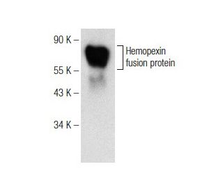 Hemopexin Antibody (F-12) - Western Blotting - Image 146466 