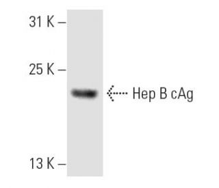 Hep B CAg抗体 (10E11) | SCBT - Santa Cruz Biotechnology