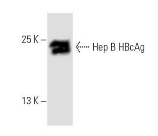Hep B cAg Antibody (13A9) - Western Blotting - Image 8848