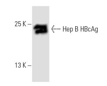 Anti Hep B Cag Antibody 13a9 Scbt Santa Cruz Biotechnology