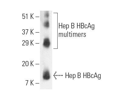 Anti Hep B Cag Antibody C1 5 Scbt Santa Cruz Biotechnology