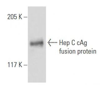 Hep C cAg Antibody (1851) - Western Blotting - Image 19127