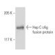 Hep C cAg Antibody (1851) - Western Blotting - Image 19127