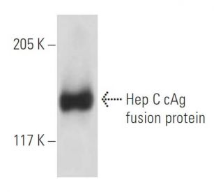Hep C cAg Antibody (1868) - Western Blotting - Image 19128