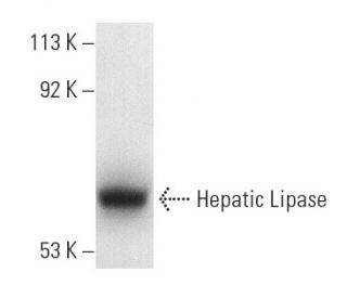 western blotting image from recommended Hepatic Lipase (XHL3-6) monoclonal antibody replacement. Image 3751