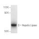 This polyclonal antibody has been discontinued. See our recommended <a href="hepatic-lipase-antibody-xhl3-6">Hepatic Lipase (XHL3-6)</a> monoclonal antibody (sample data shown). western blotting image from recommended Hepatic Lipase (XHL3-6) monoclonal antibody replacement. Image 3751